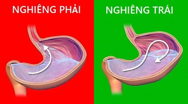 Đi ngủ nằm nghiêng bên nào mới tốt, nhất là với bà bầu? - Ảnh 2